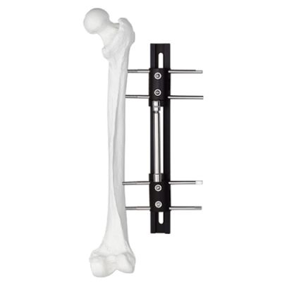 Bone Lengthening External Fixator – Type B