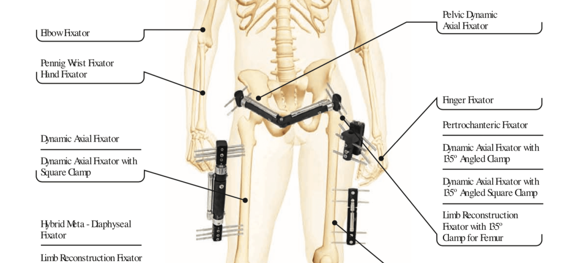 orthopromed-external-fixators