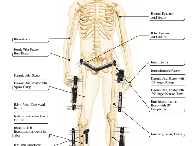 orthopromed-external-fixators